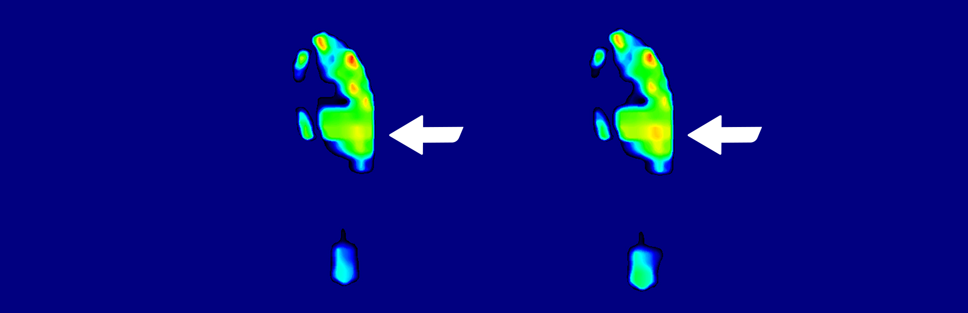 Pressure Measuring Image